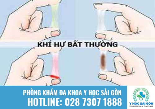 Khí hư có màu sắc bất thường